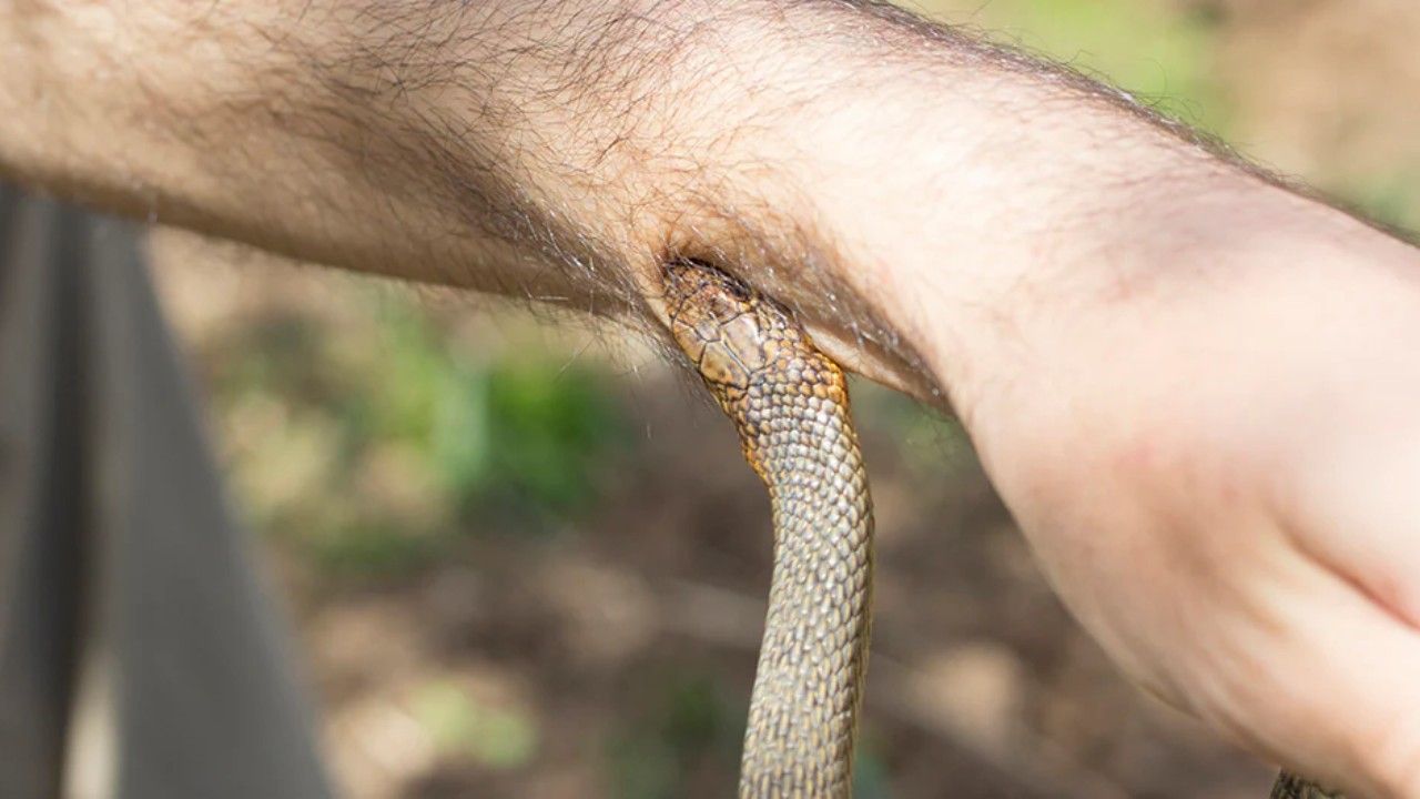 Snake bite on human hand highlighting need for immediate first aid and medical care