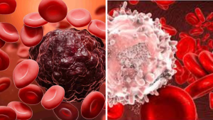Blood Cancer Symptoms, Causes and Modern Treatments in Telugu