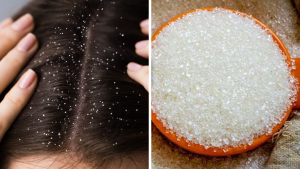 Hair-care