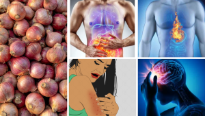 Onions 