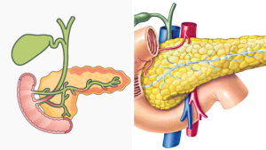 Pancreatitis