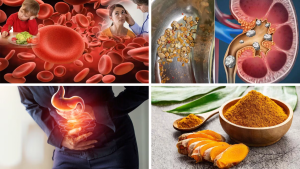 Turmeric 