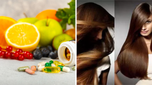 Vitamin Supplements