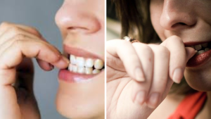 Biting Your Nails Habit and Health Risks