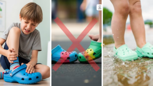 Crocs Side Effects on Children Feet Health
