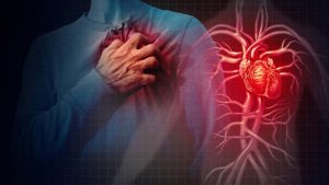 Heart Disease