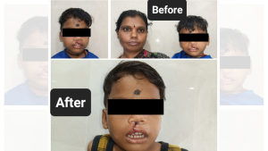 ABMSS Scheme | ప్రభుత్వ సహకారంతో జేశ్వితకు కొత్త జీవితం
