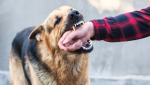 Dog Bite Rabies